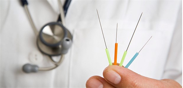Akupunktur lindert Menopausebeschwerden Fünf wöchentliche Akupunktursitzungen scheinen bereits die Menopausenbeschwerden deutlich zu lindern, ergab eine Praxisstudie.