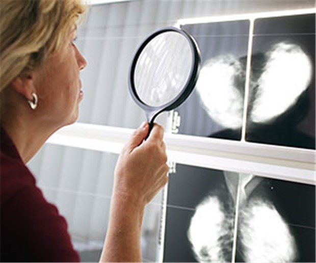 Mammografie kann schon ab 40 sinnvoll sein Für Frauen mit dichtem Brustgewebe kann sich eine Mammografie auch schon im Alter zwischen 40 und 50 lohnen, so eine US-Studie.