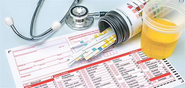 Für Laborleistungen gibt es nicht immer das volle Honorar.