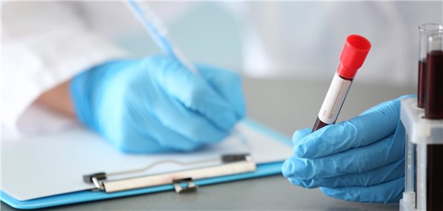 Eine Ärztin fühlt an einem Tisch einen Zettel für die Untersuchung einer von ihr entnommenen Blutprobe durch.