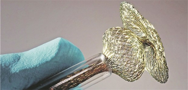 EU-Novelle auf der Zielgeraden Für bestimmte Implantate gelten bald strengere Auflagen.