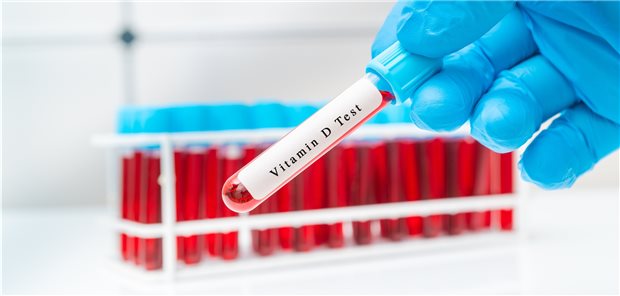 Regelmäßige Vitamin-Screenings bei Älteren offenbar ohne Nutzen Regelmäßige Vitamin-Screenings bei Älteren offenbar ohne Nutzen
