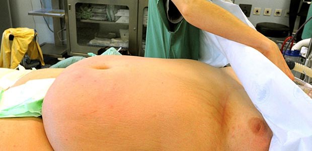 Weniger Leckagen durch dicke Bougies? Für den Magen wird es ernst.