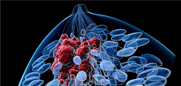 Für die Brustkrebstherapie setzen Forscher zunehmend auf die Tumorbiologie. Dadurch soll es möglich werden, biotechnologisch individuell auf den Patienten zugeschnittene Therapien bereitzustellen.
