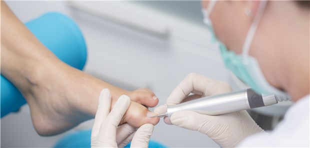 Für die Schönheit oder die Gesundheit? Bis auf Weiteres kann eine medizinische Fußpflege nur für Diabetes-Patienten verordnet werden.