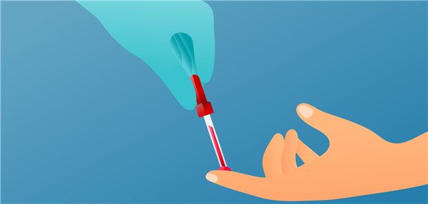 Für die Untersuchung reicht ein Blutstropfen aus der Fingerbeere aus.