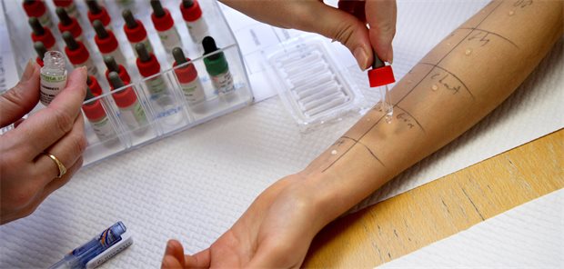 Auf einen Unterarm wird auf verschiedene Stellen Allergenlösung geträufelt für den Pricktest.