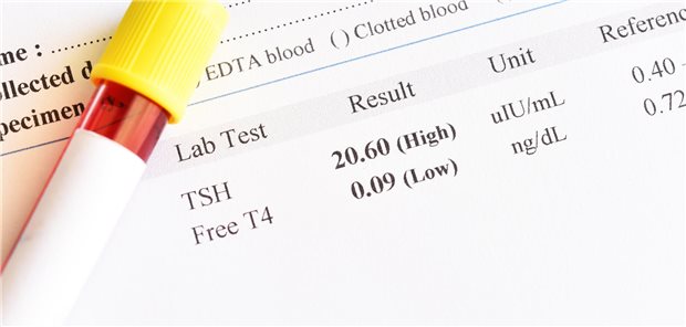 Ergebnis eines Hypothyreose-Test mit einer Blutprobe.