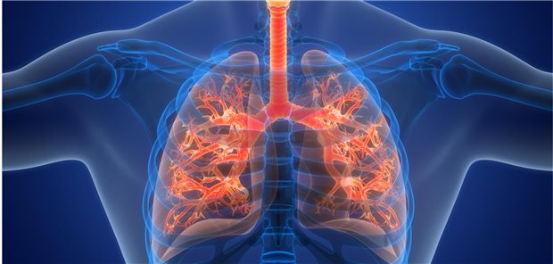 Für ihr Vorhersagemodell zur Identifikation von Patienten mit Systemische Sklerose-assoziierter interstitieller Lungenerkrankung (SSc-ILD), die wahrscheinlich eine progressiv-fibrosierende (PF-) ILD bekommen, spielen neun Variablen eine Rolle: Alter 50 Jahre, Hyperlipidämie, Raucheranamnese, SSc vom diffus-kutanen Typ, Arthritis, Luftnot, verminderter Immunglobulin (Ig)-A-Spiegel, positive Anti-Scl-70-Antikörper und der Erhalt von Cyclophosphamid oder Mycophenolatmofetil.
