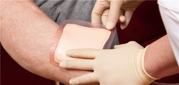 Für rund 400 „Sonstige Produkte zur Wundbehandlung“ müssen deren Hersteller – Stand jetzt – ab dem 2. Dezember 2023 einen Nutzennachweis erbringen, um sie in der Erstattungsfähigkeit zu halten.