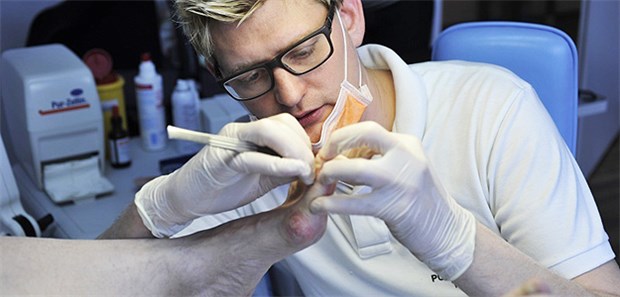 Risiko für Erblindung und Amputation lässt sich berechnen Fußpflege beim Podologen undregelmäßige Kontrolle der Füße ist jedem Patienten mit Diabetesmellitus zu empfehlen.