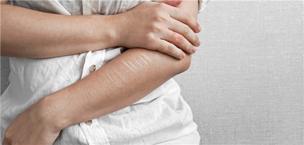 Ein Mann greift sich an den Arm, auf dem Narben, wohl von einem Messer, zu erkennen sind.