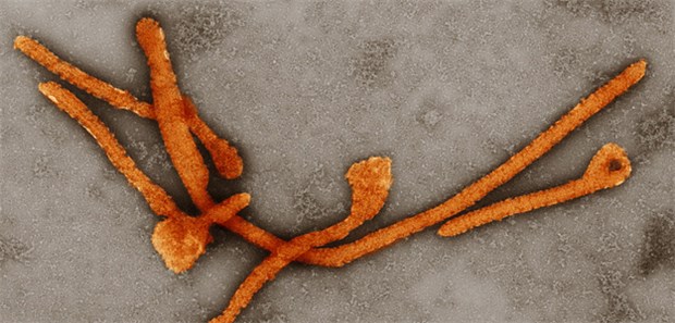 Notstand in Westafrika - über 720 Tote Gefährliche Fäden: Ebola-Viren unter dem Elektronenmikroskop.