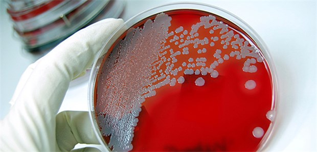 Verordnen Deutschlands Ärzte falsche Antibiotika? Gefährliche Kolonien: Die hiesige Verordnungspraxis von Antibiotika könnte die Bildung von resistenten Keimen begünstigen, monieren Experten.