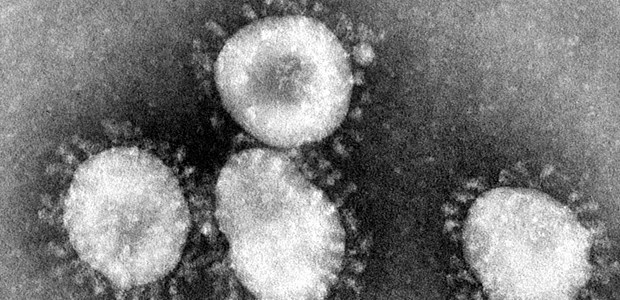 Ein Coronavirus bedroht die Welt Gefährliche Kügelchen: Das MERS-CoV hält die Virologen in Atem.