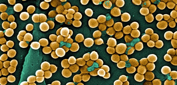 Mehr MRSA in Pflegeheimen als gedacht Gefährliche Kügelchen: MRSA in Bunt.