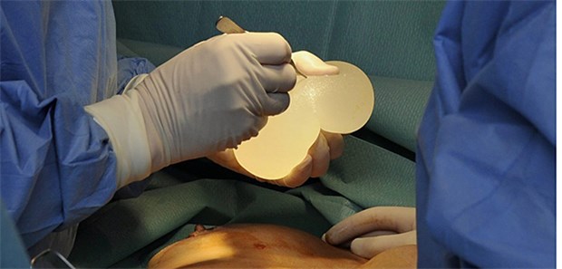 EuGH-Urteil im Brustimplantate-Skandal erwartet Gefährliches Implantat? Allein in Deutschland sollen rund 5000 Frauen Brustimplantate mit Industrie-Silikon erhalten haben.