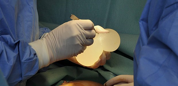 Ein Urteil macht noch keine Entschädigung Gefährliches Implantat? Allein in Deutschland sollen rund 5000 Frauen Brustimplantate mit Industrie-Silikon erhalten haben.