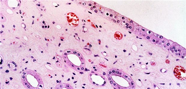 Gefärbter Schnitt einer Niere. Das Organ versagt nicht häufiger bei Über-65-Jährigen, wenn ein altersadjustierter eGFR-Wert von 45-59 verwendet wird, berichten kanadische Forscher.
