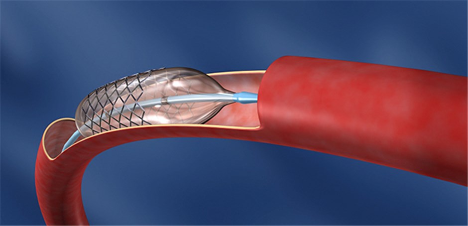 Zwei Verfahren erleichtern die Diagnose