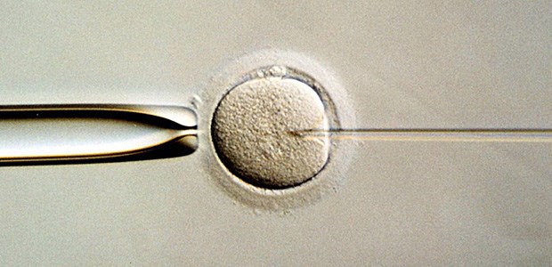 IVF - Riskantes Mutterglück? Gefahr für Thromboembolien?