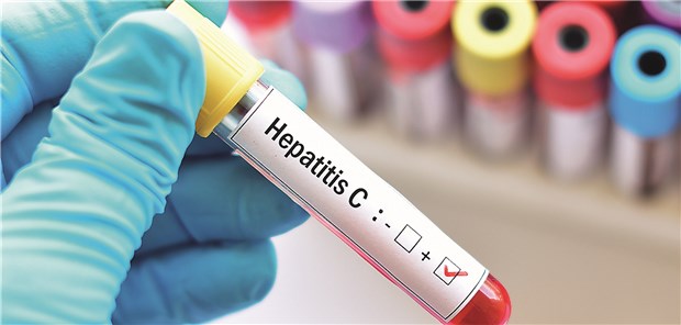 Gegen HCV stehen heute effektive Therapieregimes mit DAA zur Verfügung.