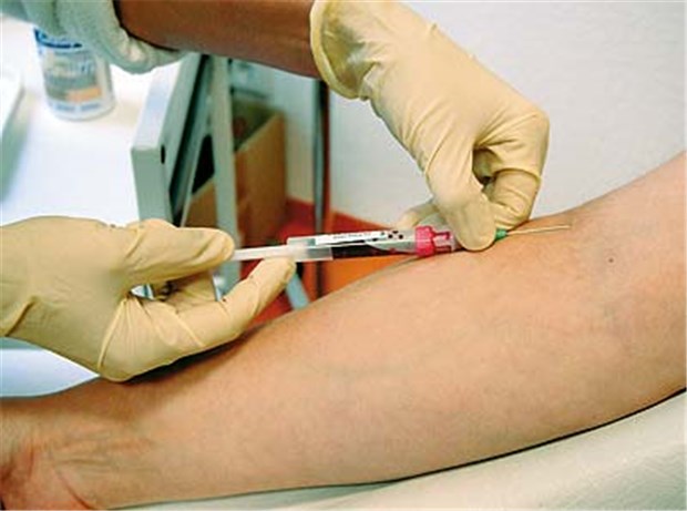 Bald Revision der Diabetes-Diagnostik? Geht es nach der Expertenkommission, soll künftig der HbA1c-Wert für die Diagnose Diabetes entscheidend sein.