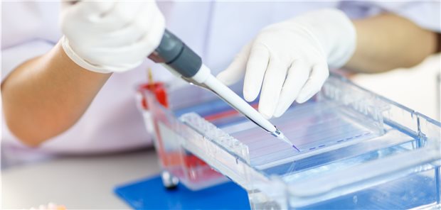 Gelelektrophorese: Mit dieser Methode lassen sich Proteine nach ihrer Größe auftrennen. In einem Eschenpollenextrakt stießen die Wissenschaftler so auf das 53-kDa-Protein.