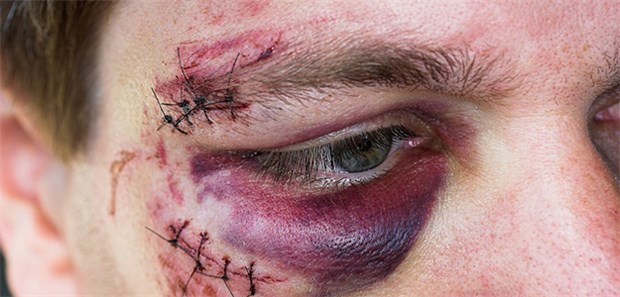 Generell ist jeder Vertragsarzt verpflichtet, Verletzte nach einem Arbeits- oder Wegeunfall zu behandeln. Durchgangsärzte koordinieren dann die weitere Behandlung.