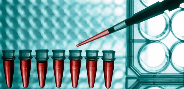 Eine neue Chance für HIV-Infizierte Gentherapie bei HIV-Infizierten ist jetzt wieder ein Thema.