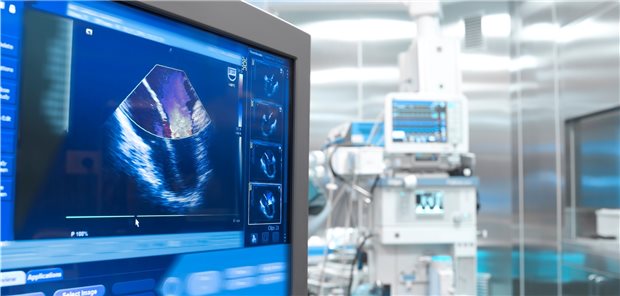 Gerade bei immobilen Patienten auf der Intensivstation, die künstlich beatmet werden, ist die schonend am Bett vorzunehmende Echokardiographie optimal