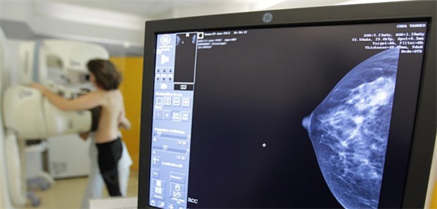 Entdeckte Brustkrebsvorstufen sind meist aggressiv Gerade die regelmäßig teilnehmenden Frauen profitieren besonders vom Mammographie-Screening, ergab eine Analyse der Uni Münster.