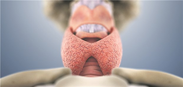 Gesunde Schilddrüse? Bei Patienten im höheren Lebensalter wird zu selten an eine Hyperthyreose gedacht, da sie oft oligo- oder monosymptomatisch verläuft.