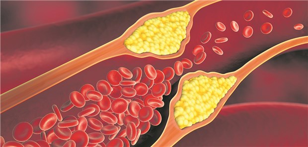 Gesunder Lebensstil und Medikation schützen Herz- und Hirngefäße.