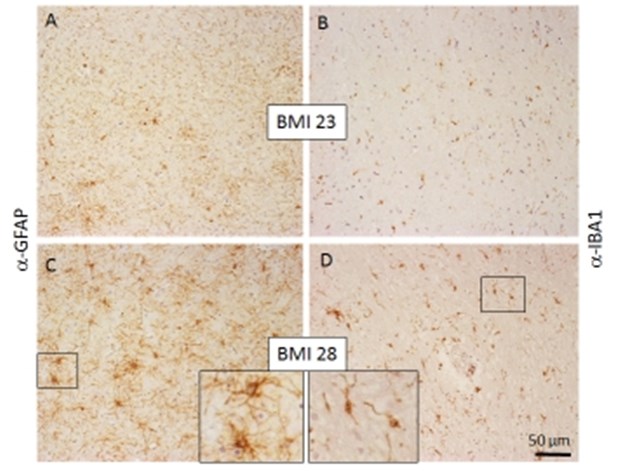 Wie Darmbakterien Übergewicht auslösen könnten Gewebeschnitte: Bei übergewichtigen Personen (untere Reihe) ist das Gewebe im Hypothalamus deutlich dichter, was auf Entzündungen hinweist.