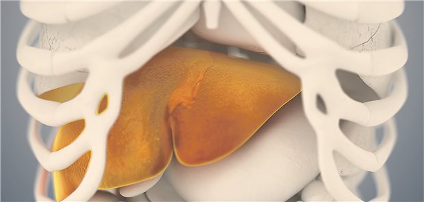 Gewichtsabnahme mit Nahrungsumstellung und körperlicher Aktivität gilt als effektivster Weg, eine NAFLD/NASH zu bremsen.