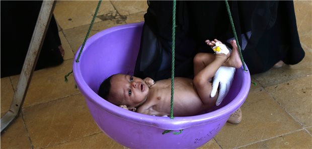 COVID-19 – die große Gefahr für die humanitären Helfer Gewichtskontrolle bei einem Baby in einem Krankenhaus in Jemen. Im Jemen hat der Bürgerkrieg für eine äußerst defizitäre Gesundheitsversorgung gesorgt, die schon die Kleinsten trifft.