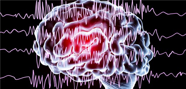 Gewitter im Hirn: Epilepsie-Patienten erfahren oft Stigmatisierung und Diskriminierung. Das will die WHO nun ändern.
