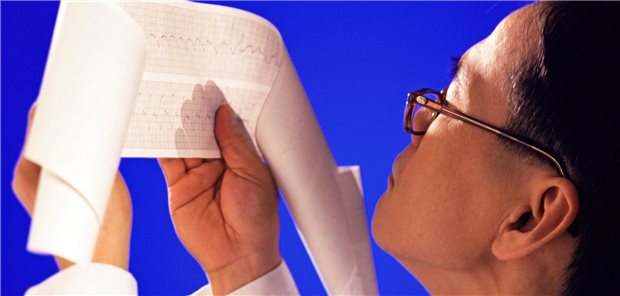 Gibt es im EKG Zeichen für einen Infarkt? Die EKG-Schwellenwerte, ab wann von einem ST-Streckenhebungsinfarkt auszugehen ist, sind hauptsächlich an Personen mit westeuropäischer Herkunft evaluiert worden.