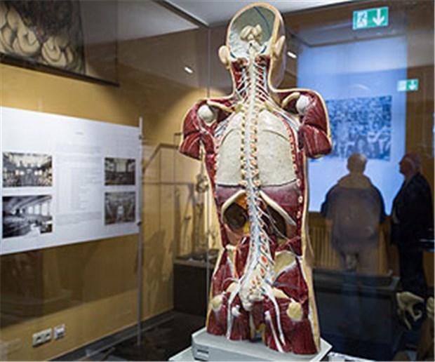 Von Seeleuten, Syphilis und Sektionstischen Gipsmodell eines Rückens: Eines von vielen Exponaten.