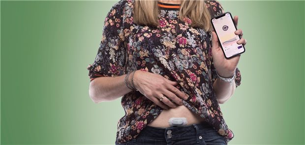 Glukosewerte in Echtzeit: Der CGM-Sensor überträgt die Messwerte alle fünf Minuten auf ein Empfangsgerät oder ein Smartphone.
