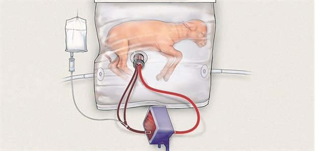 Lämmer-Frühchen reifen in künstlicher Fruchtblase Grafische Darstellung eines Lamm-Frühchens in einem sogenannten „Biobag“, einer Art künstlicher Gebärmutter. “