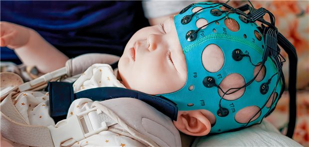 Größere Schmerzen in der frühen Kindheit scheinen mit einer Hypokonnektivität im neonatalen Gehirn verbunden zu sein, wobei die stärksten Assoziationen in den Basalganglien und den limbischen Strukturen beobachtet wurden. Eine verringerte strukturelle Konnektivität des Gehirns wurde mit schlechteren neurologischen Entwicklungsergebnissen nach 18 Monaten in Verbindung gebracht.