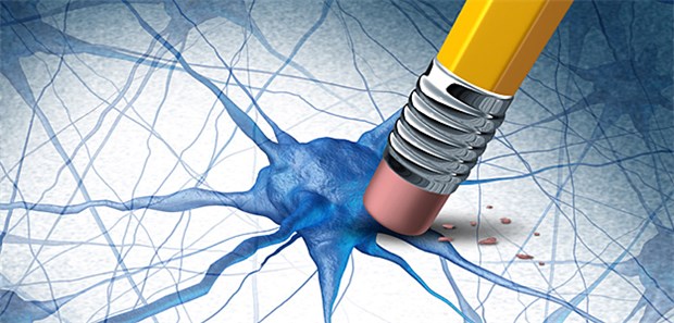 Gentherapie mit NGF nützt nichts bei Alzheimer Große Hoffnungen auf NGF: In einer kontrollierten Studie ist der Wachstumsfaktor bei Alzheimerpatienten aber gescheitert.