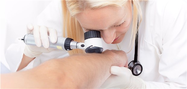 Gut- oder bösartig? Mit Dermatoskop lässt sich beim Screening mehr erkennen.