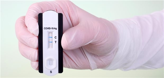 Corona-Variante EG.5 breitet sich aus, ist aber „keine besondere Gefahr“ Guter alter Bekannter: Werden wir Corona-Schnelltests bald wieder häufiger brauchen – und welche Bedeutung hat bei Erkrankungsfällen künftig die Corona-Variante EG.5?
