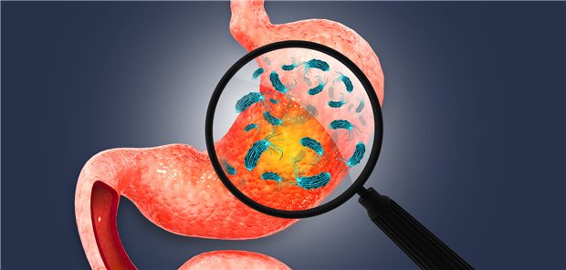 3D-Illustration von H. pylori-Bakterien.