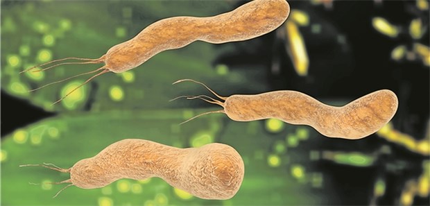 H. pylori: Sind Präneoplasien entstanden, schreitet der Krankehitsprozess unumkehrbar voran.