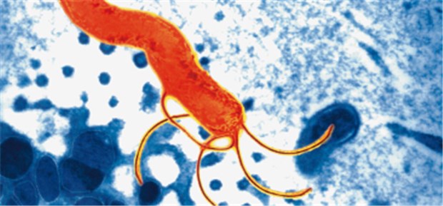 Eradikation auch bei schon abgeheiltem Ulkus H. pylori im Magen? Auch bei funktioneller Dyspepsie hilft dann manchmal die Eradikationstherapie.