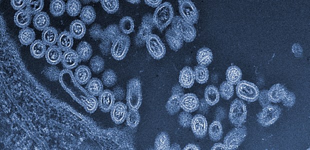 Forscher wollen neues Pandemie-Virus züchten H7N9 bricht aus der Zelle aus: Forscher wollen dem Virus die Fähigkeit zur Pandemie beibringen.